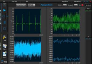 Spindle analysis